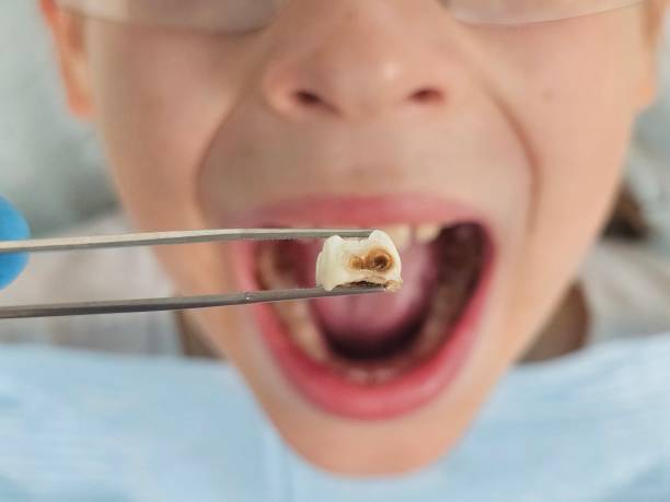 Best Urgent Tooth Repair  in Oronoco, MN
